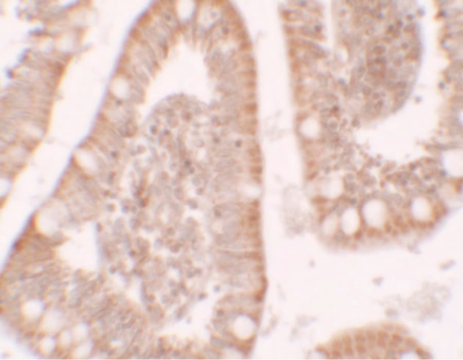 Polyclonal Rabbit anti-Human RC3H1 / ROQUIN Antibody (IHC, IF, WB)