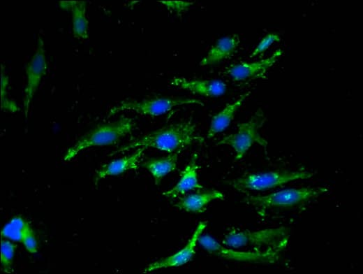 Polyclonal Rabbit anti-Human CASP12 / Caspase 12 Antibody (IHC, IF, WB)