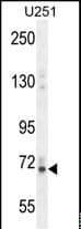 VIT Antibody (aa567-595)