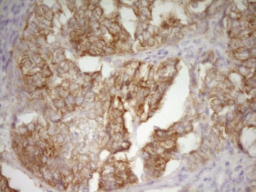 DVL2 / Dishevelled 2 Antibody (aa1-320, clone OTI7C7)