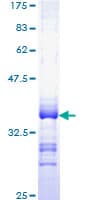 Human SLC19A2 / TC1 Protein (Recombinant GST, N-terminus)