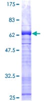 Human PAX9 Protein (Recombinant GST)