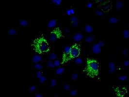 Monoclonal Mouse anti-Human HMRF1L / MTRF1L Antibody (clone OTI1H7, IHC, IF, WB)