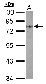 GOLM1 / GP73 / GOLPH2 Antibody (aa339-401)