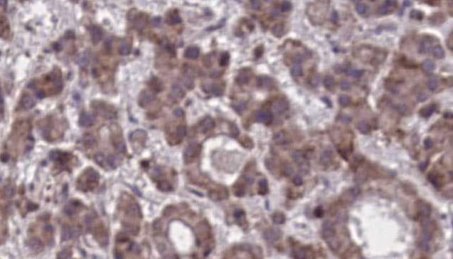 ADGRG3 / GPR97 Antibody