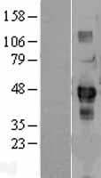 SDCCAG3 Protein (Over-Expression Lysate Myc-DDK (Flag))