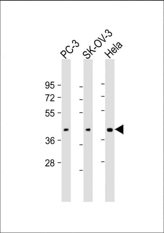 ST3GAL4 / ST3Gal IV Antibody (N-Terminus)