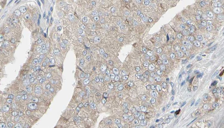 LDHB / Lactate Dehydrogenase B Antibody