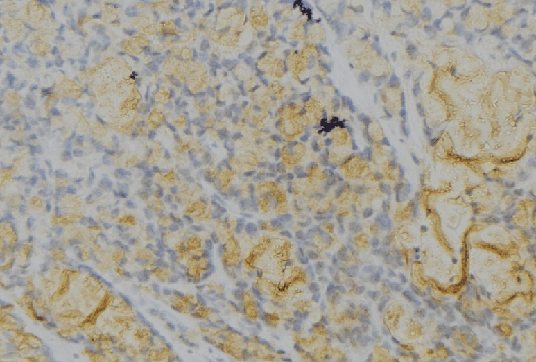 THBS1 / Thrombospondin-1 Antibody