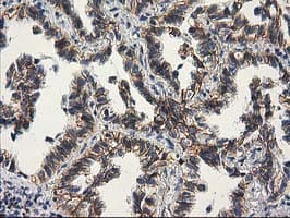 CTNNB1 / Beta Catenin Antibody (clone OTI1E10, Carrier-free)