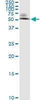 ODC1 / Ornithine Decarboxylase Antibody (clone 2G5)