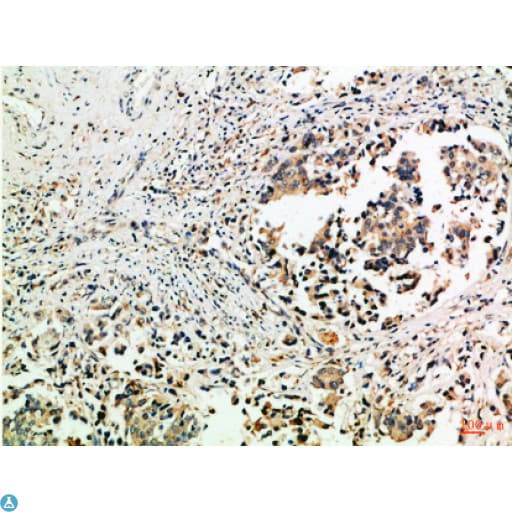 Tubulin Gamma Antibody