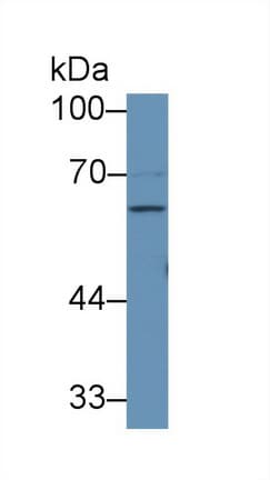 F9 / Factor IX Antibody (aa232-455)