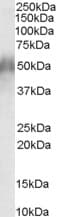 IHC-plus™ CD2BP2 Antibody (aa2-14)