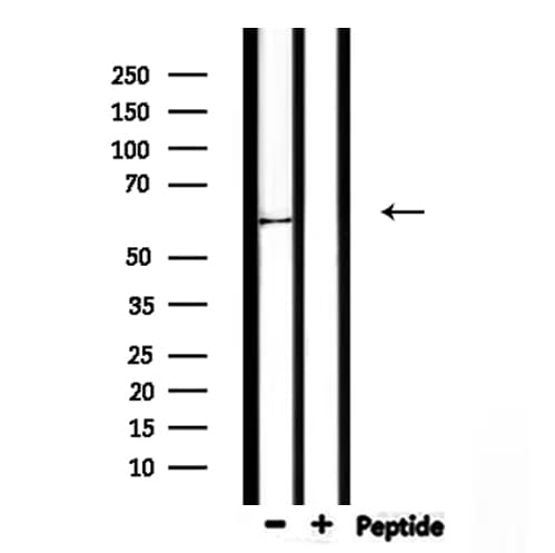 KRT9 / CK9 / Cytokeratin 9 Antibody