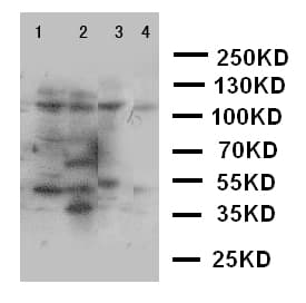 Polyclonal Rabbit anti-Human PLA2G4A Antibody (aa686-700, WB)