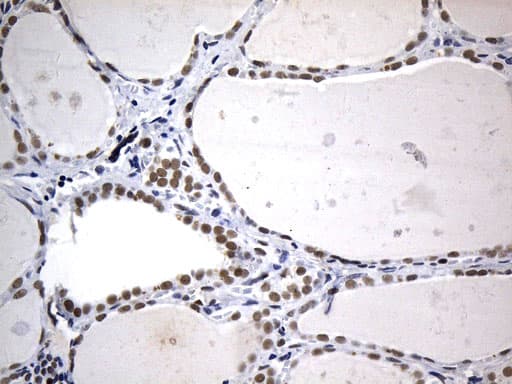 FOXP1 Antibody (clone UMAB242)