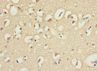 Polyclonal Rabbit anti-Human IL21 Receptor Antibody (IHC, WB)