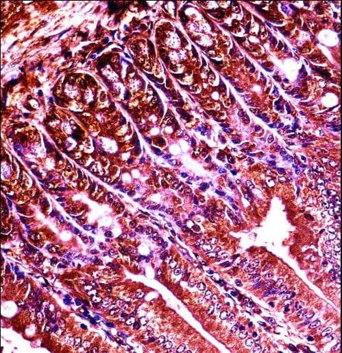 Polyclonal Rabbit anti-Human ABL1 / c-ABL Antibody (aa613-641, IHC, WB)