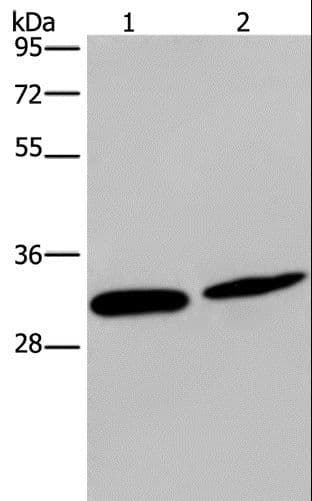 Polyclonal Rabbit anti-Human GJB4 / CX30.3 / Connexin 30.3 Antibody (IHC, WB)