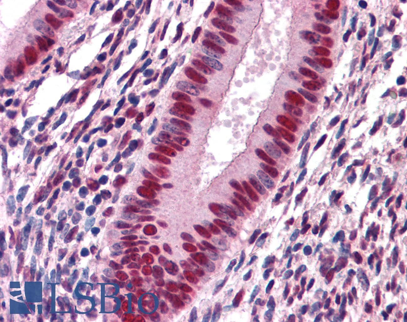 IHC-plus™ SAFB1 / SAFB Antibody (clone 5A11)