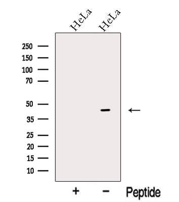 Polyclonal Rabbit anti-Human OFD1 Antibody (WB)
