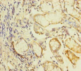 Polyclonal Rabbit anti-Human KLHL26 Antibody (IHC)