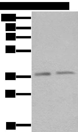 Polyclonal Rabbit anti-Human ATXN7L3 Antibody (IHC, WB)