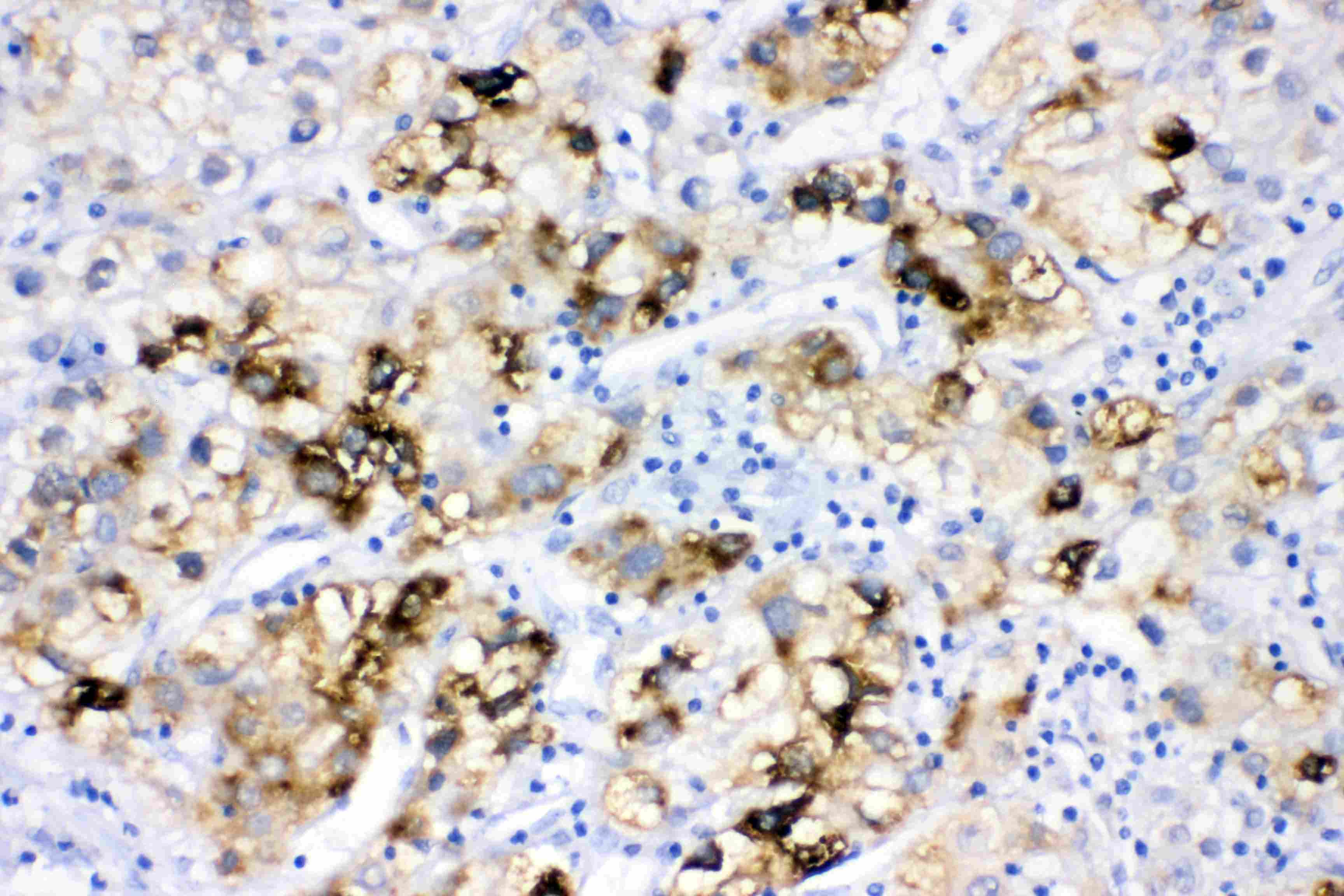 Polyclonal Rabbit anti-Human FACL2 / ACSL1 Antibody (IHC, WB)