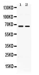 Polyclonal Rabbit anti-Human ACCN1 / ASIC2 Antibody (WB)