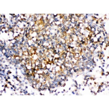 CD30L / CD153 Antibody (aa63-234)