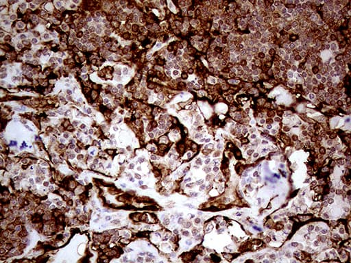 TGM2 / Transglutaminase 2 Antibody (clone OTI2F9, Carrier-free)