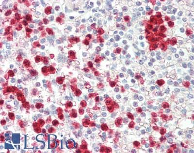 SAMHD1 Antibody (phospho-Thr592)