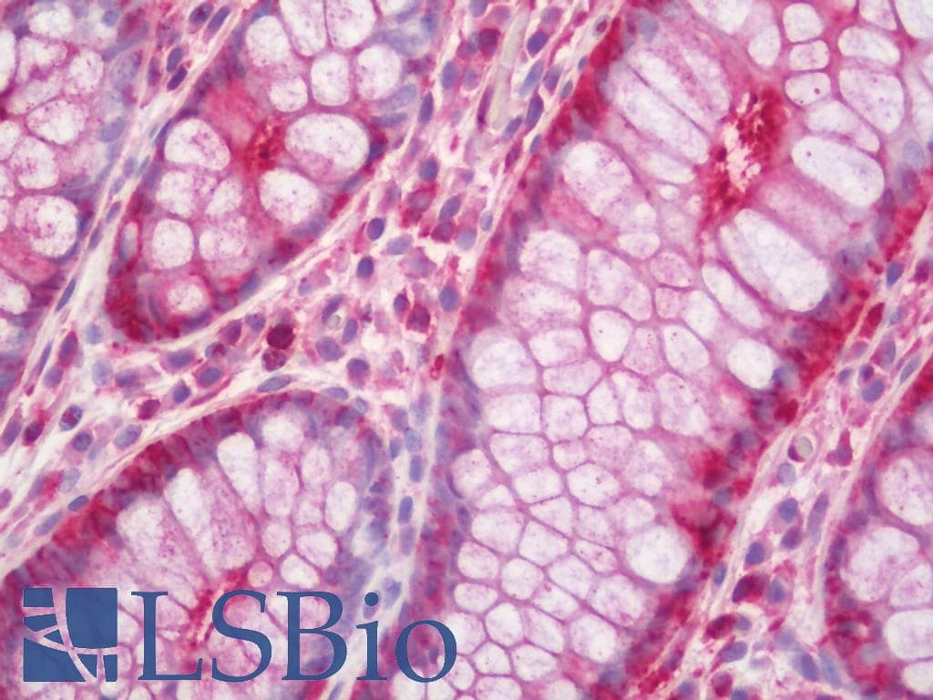 IHC-plus™ CASP8 / Caspase 8 Antibody (aa313-362)