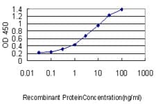 PPARD / PPAR Delta Antibody (clone 4E3-1B11)