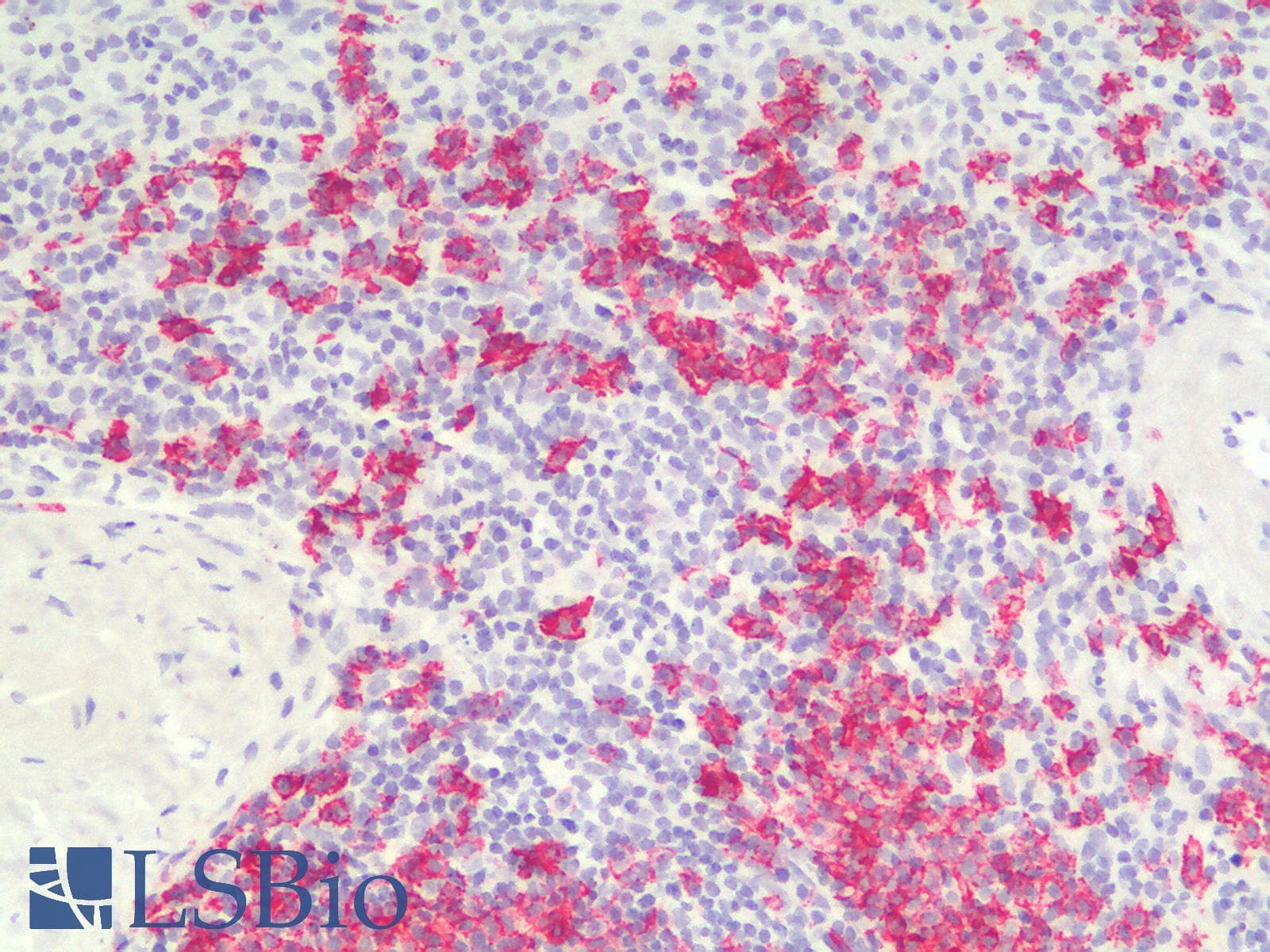PathPlus™ CD20 Antibody (clone IGEL/1497R)