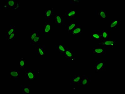 Polyclonal Rabbit anti-Human HIST1H2AI Antibody (IHC, IF)