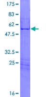 Human HOXA7 Protein (Recombinant GST)