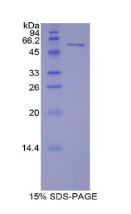 Mouse MAP2 Protein (Recombinant His-GST)