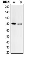 Tyrosinase Antibody (C-Terminus)