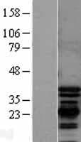 PDLIM1 Protein (Over-Expression Lysate Myc-DDK (Flag))