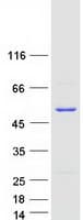 Human SNX5 Protein (Recombinant Myc-DDK (Flag))