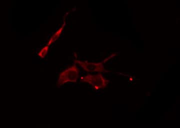 Polyclonal Rabbit anti-Human ACER3 Antibody (IHC, IF, WB)