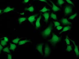 SIRT5 / Sirtuin 5 Antibody (clone OTI2A11)