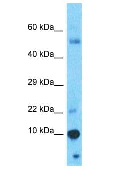 GAGEC1 / JM27 Antibody (aa14-63)