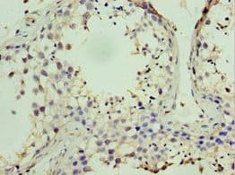 Polyclonal Rabbit anti-Human STK38 Antibody (aa1-200, IHC)