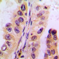 CYP3A4+5 Antibody (Internal)