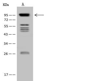 Polyclonal Rabbit anti-Human HCCS1 / VPS53 Antibody (WB)