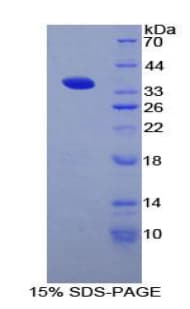 Rat CD1D Protein (Recombinant His-T7)