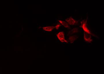 RPS20 / Ribosomal Protein S20 Antibody